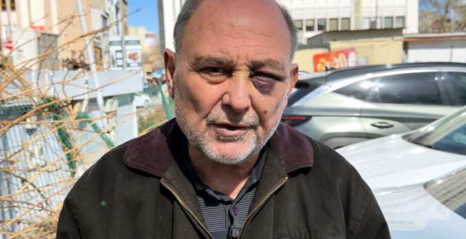 Cenazeden Dönen Vatandaşa Çocuklardan Saldırı: “Şu Anda Çift Görüyorum”